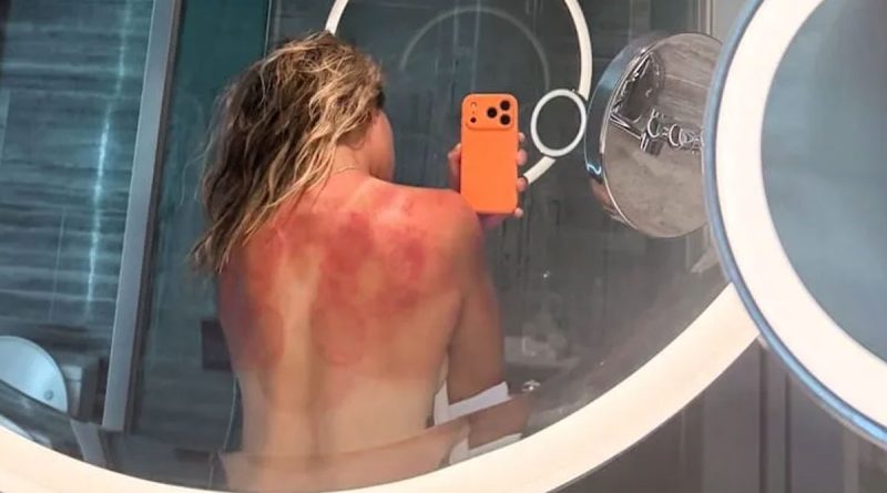 Renata Zarazúa: "El sol de Australia no es broma"